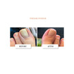 Фото складу Puremedy, Clarifying Nail Ointment, Мазь для шкіри, 28 г