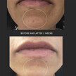 Фото состава Dermacleanse Acne Spot Treatment Gel Фото состава ZENMED, Средства от прыщей, Dermacleanse Acne Spot Treatment Gel,