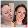 Фото применение ZENMED, Уход за лицом, Facial Cleansing Gel, 180 мл