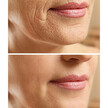 Фото використання Zion Health, Wrinkle Erase - Fast Action Night Cream, Крем, 30 мл