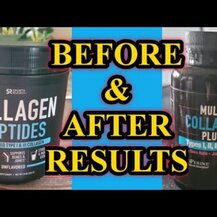 Vital Vitamins, Multi Collagen Complex, Колаген, 150 капсул