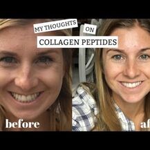 Коллагеновые пептиды, Collagen Peptides Unflavored, 560 г