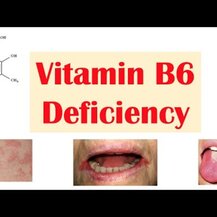 Bluebonnet Nutrition, Vitamin B-6 200 mg