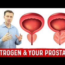 NOW Foods, Nettle Root Extract Stinging 250 mg