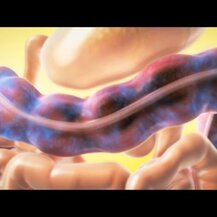 NutraChamps, Colon Cleanse