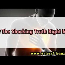 Natural Dynamix, Krill Oil DX 1000 mg