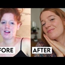 Thorne, Bacillus Coagulans