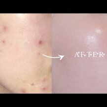 Olympian Labs, DIM-100