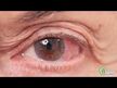 Відео огляд на Dr. Mercola, Eye Support 30, Підтримка здоров'я зору, 30 кап